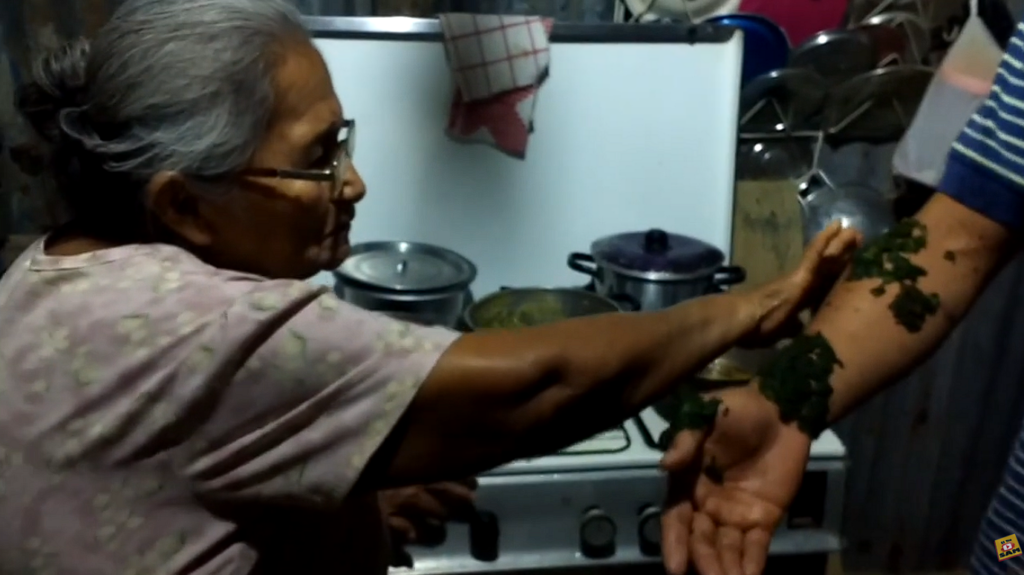 oregano para quemaduras